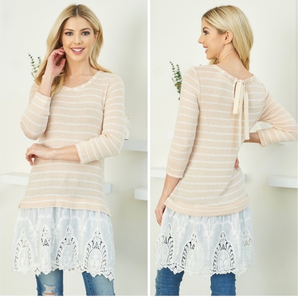 Ryu A’reve Striped Tunic With Lace Detailing